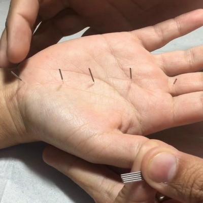 Manupuncture coréenne